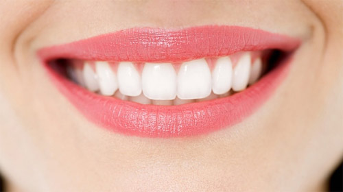 Răng sứ không kim loại Cercon – Răng sứ cho chất lượng hoàn hảo
